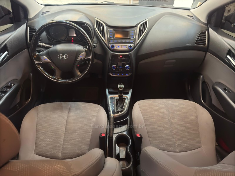 HB20S 1.6 PREMIUM 16V FLEX 4P AUTOMÁTICO - 2016 - BOM RETIRO DO SUL