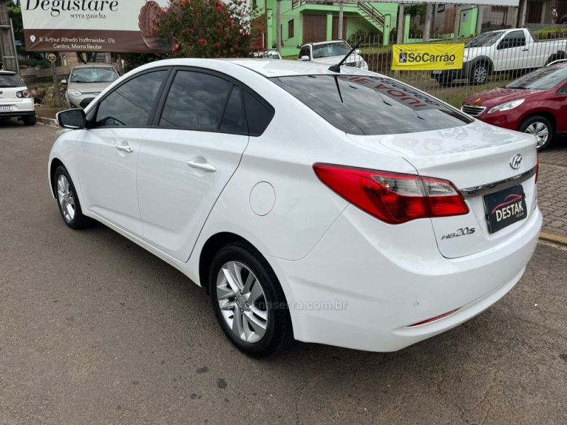 HB20S 1.6 PREMIUM 16V FLEX 4P AUTOMÁTICO - 2014 - DOIS IRMãOS