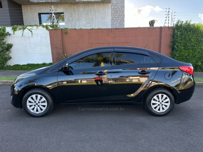 HB20S 1.0 COMFORT PLUS 12V FLEX 4P MANUAL - 2014 - SãO LEOPOLDO