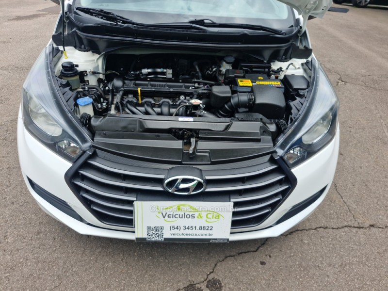 HB20S 1.6 COPA DO MUNDO 16V FLEX 4P AUTOMÁTICO - 2019 - BENTO GONçALVES