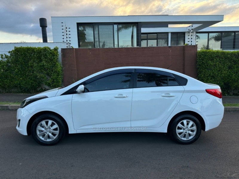HB20S 1.6 COMFORT PLUS 16V FLEX 4P MANUAL - 2015 - SãO LEOPOLDO