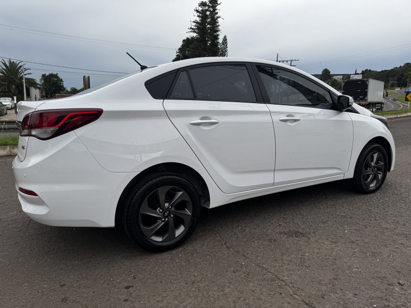 HB20S 1.6 COMFORT STYLE 16V FLEX 4P MANUAL - 2016 - DOIS IRMãOS