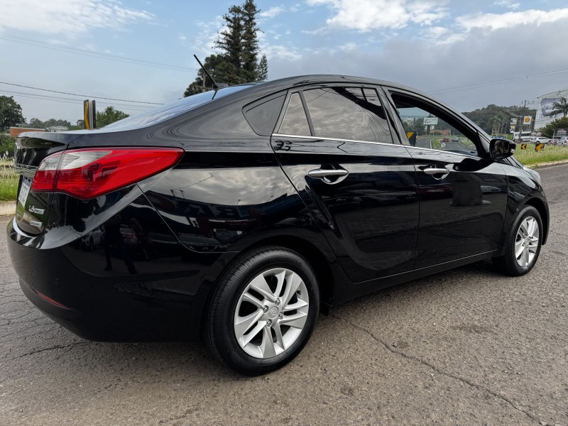 HB20S 1.6 PREMIUM 16V FLEX 4P AUTOMÁTICO - 2015 - DOIS IRMãOS