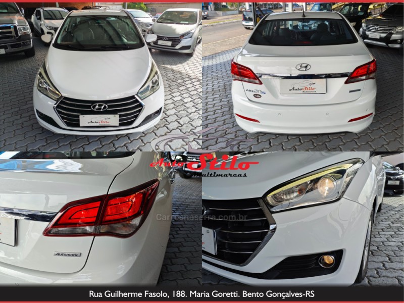 HB20S 1.6 PREMIUM 16V FLEX 4P AUTOMÁTICO - 2016 - BENTO GONçALVES