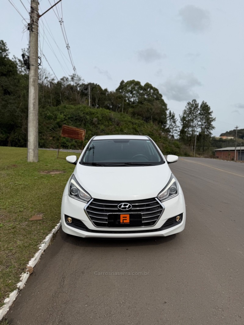 HB20S 1.6 PREMIUM 16V FLEX 4P AUTOMÁTICO - 2017 - NOVA ARAçá