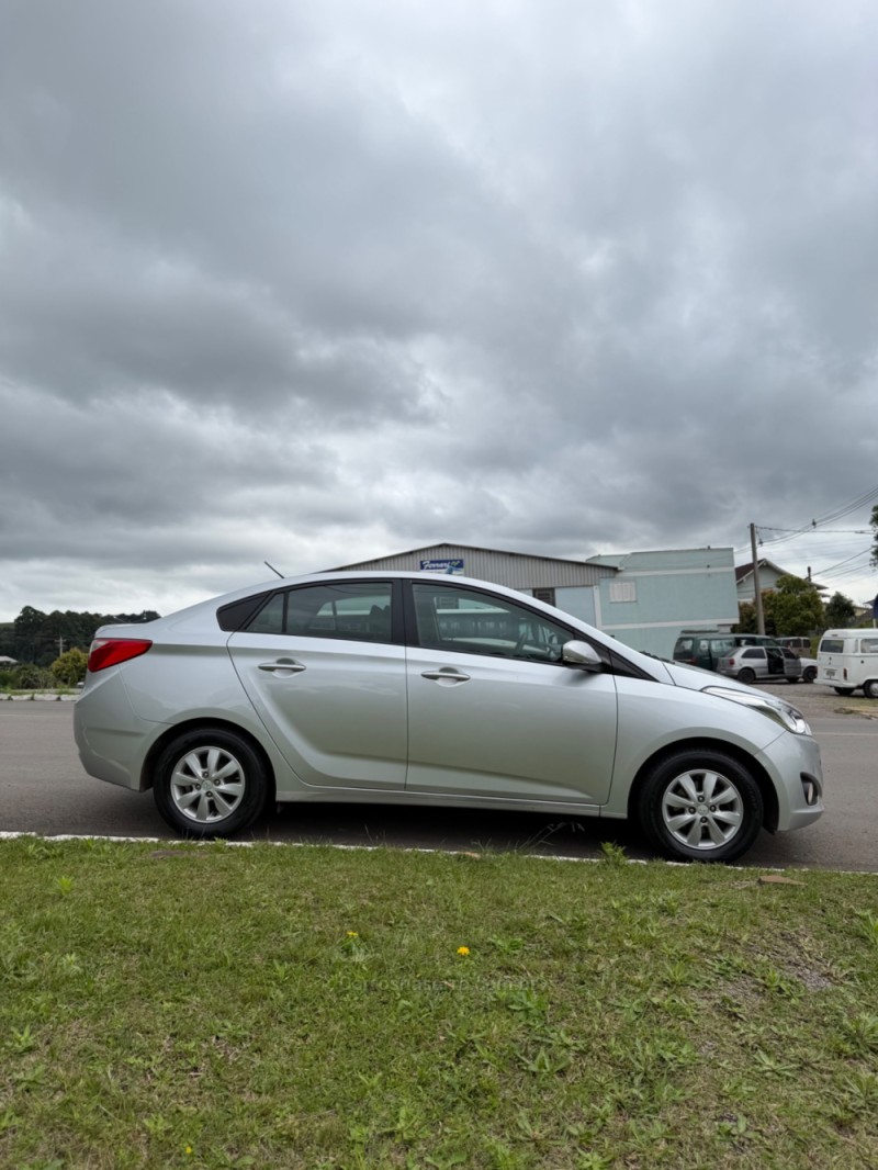 HB20S 1.6 COMFORT PLUS 16V FLEX 4P AUTOMÁTICO - 2014 - NOVA ARAçá