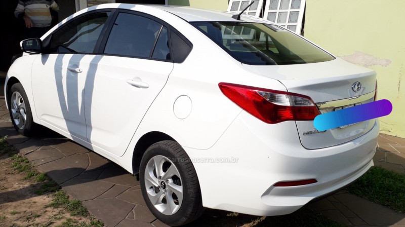 HB20S 1.6 COMFORT PLUS 16V FLEX 4P MANUAL - 2017 - BENTO GONçALVES