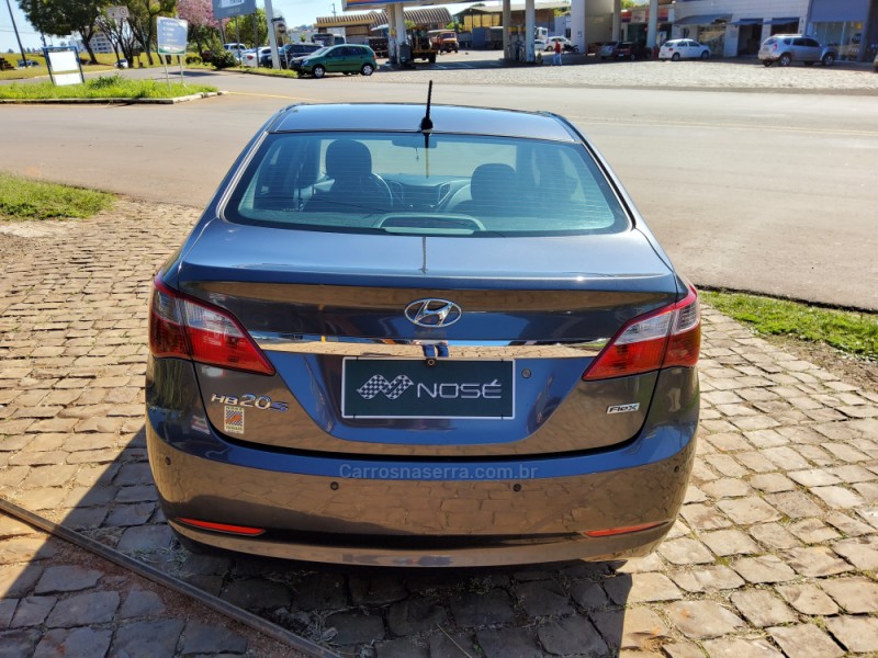 HB20S 1.0 COMFORT PLUS 12V FLEX 4P MANUAL - 2014 - NãO-ME-TOQUE